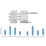 Anti-ATM (phospho-S1987) Antibody from Bioworld Technology (BS64020) - Antibodies.com