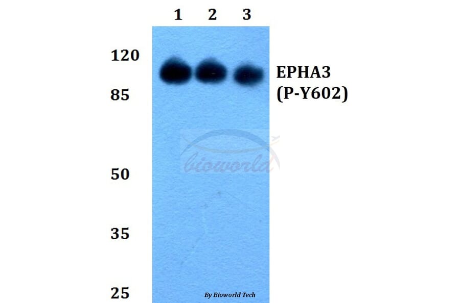 Anti-EphA3 (phospho-Y602) Antibody from Bioworld Technology (BS64024) - Antibodies.com