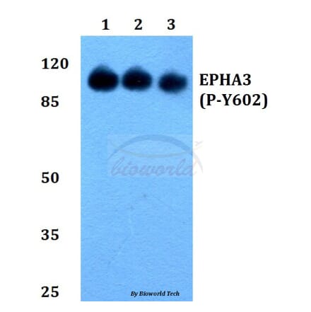 Anti-EphA3 (phospho-Y602) Antibody from Bioworld Technology (BS64024) - Antibodies.com