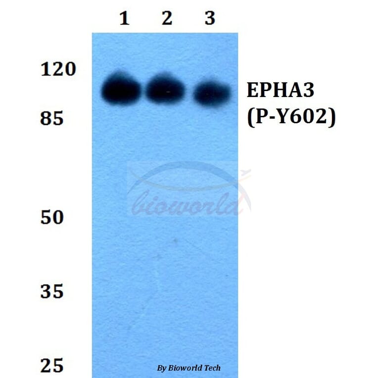Anti-EphA3 (phospho-Y602) Antibody from Bioworld Technology (BS64024) - Antibodies.com