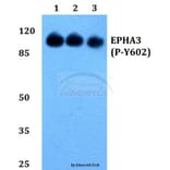 Anti-EphA3 (phospho-Y602) Antibody from Bioworld Technology (BS64024) - Antibodies.com