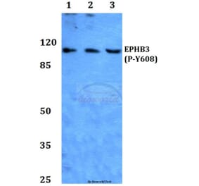 Anti-EphB3 (phospho-Y608) Antibody from Bioworld Technology (BS64025) - Antibodies.com