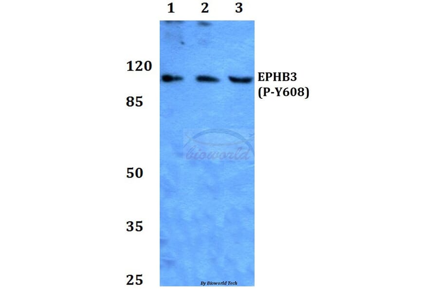 Anti-EphB3 (phospho-Y608) Antibody from Bioworld Technology (BS64025) - Antibodies.com