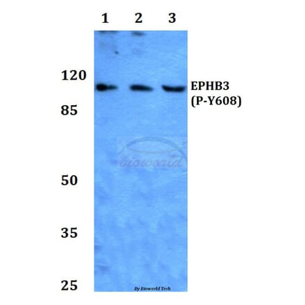 Anti-EphB3 (phospho-Y608) Antibody from Bioworld Technology (BS64025) - Antibodies.com