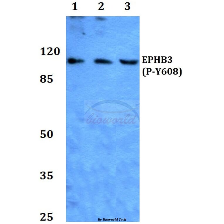 Anti-EphB3 (phospho-Y608) Antibody from Bioworld Technology (BS64025) - Antibodies.com