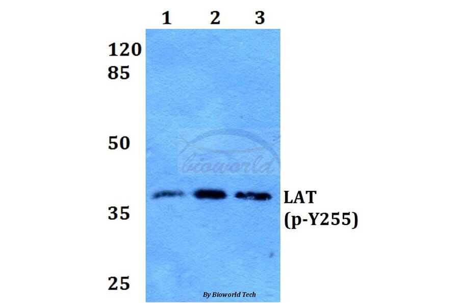 Anti-LAT (phospho-Y255) Antibody from Bioworld Technology (BS64026) - Antibodies.com