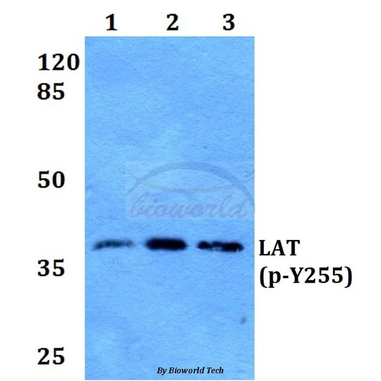 Anti-LAT (phospho-Y255) Antibody from Bioworld Technology (BS64026) - Antibodies.com
