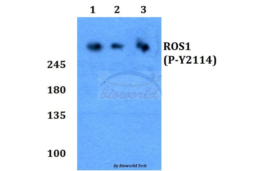 Anti-ROS (phospho-Y2114) Antibody from Bioworld Technology (BS64028) - Antibodies.com