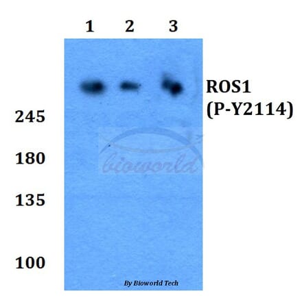 Anti-ROS (phospho-Y2114) Antibody from Bioworld Technology (BS64028) - Antibodies.com