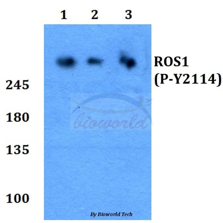 Anti-ROS (phospho-Y2114) Antibody from Bioworld Technology (BS64028) - Antibodies.com