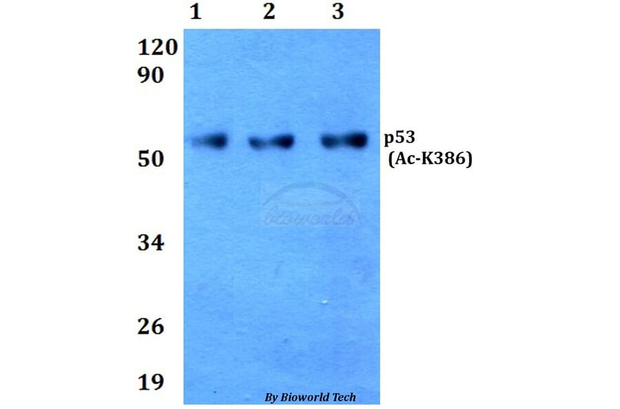 Anti-p53 (Acetyl-K386) Antibody from Bioworld Technology (BS64033) - Antibodies.com