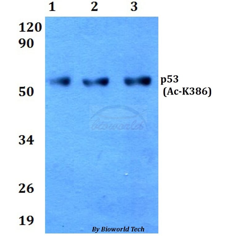 Anti-p53 (Acetyl-K386) Antibody from Bioworld Technology (BS64033) - Antibodies.com