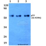 Anti-p53 (Acetyl-K386) Antibody from Bioworld Technology (BS64033) - Antibodies.com