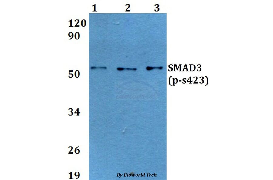 Anti-SMAD3 (phospho-S423) Antibody from Bioworld Technology (BS64037) - Antibodies.com