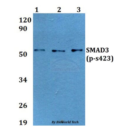 Anti-SMAD3 (phospho-S423) Antibody from Bioworld Technology (BS64037) - Antibodies.com