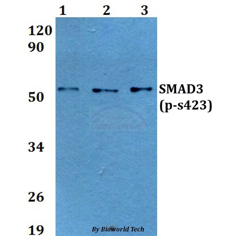 Anti-SMAD3 (phospho-S423) Antibody from Bioworld Technology (BS64037) - Antibodies.com
