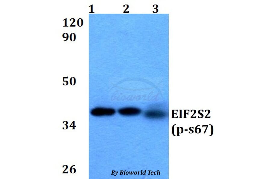 Anti-EIF2S2 (phospho-S67) Antibody from Bioworld Technology (BS64038) - Antibodies.com