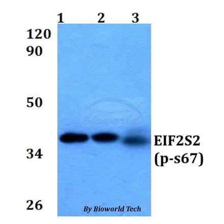 Anti-EIF2S2 (phospho-S67) Antibody from Bioworld Technology (BS64038) - Antibodies.com