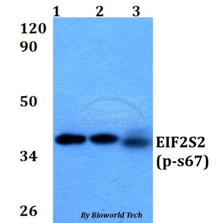 Anti-EIF2S2 (phospho-S67) Antibody from Bioworld Technology (BS64038) - Antibodies.com