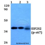 Anti-EIF2S2 (phospho-S67) Antibody from Bioworld Technology (BS64038) - Antibodies.com