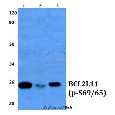 Anti-Bim (phospho-S69/S65) Antibody from Bioworld Technology (BS64039) - Antibodies.com
