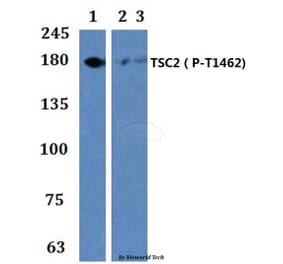 Anti-TSC2 (phospho-T1462) Antibody from Bioworld Technology (BS64040) - Antibodies.com