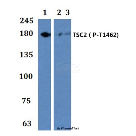 Anti-TSC2 (phospho-T1462) Antibody from Bioworld Technology (BS64040) - Antibodies.com