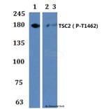 Anti-TSC2 (phospho-T1462) Antibody from Bioworld Technology (BS64040) - Antibodies.com