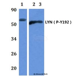 Anti-LYN (phospho-Y192) Antibody from Bioworld Technology (BS64043) - Antibodies.com