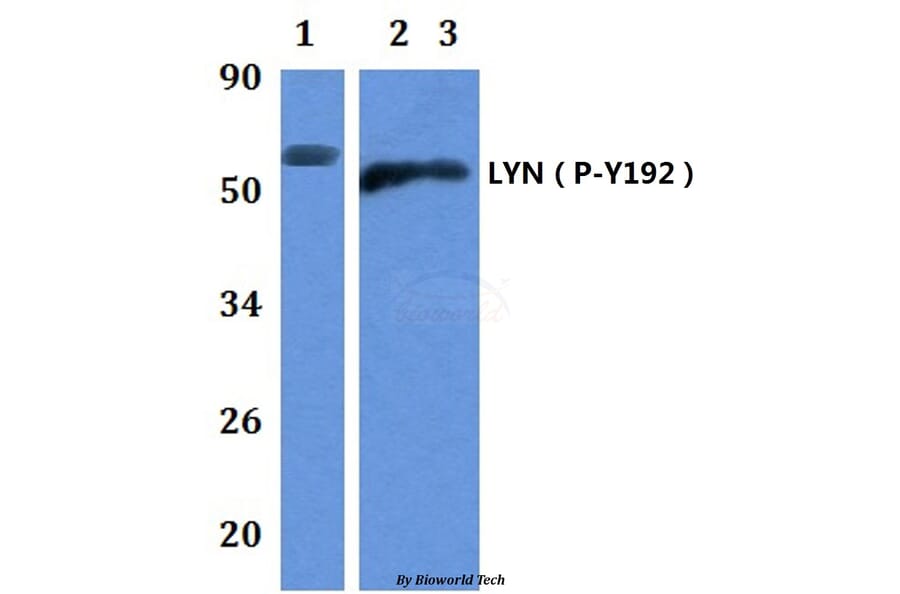Anti-LYN (phospho-Y192) Antibody from Bioworld Technology (BS64043) - Antibodies.com