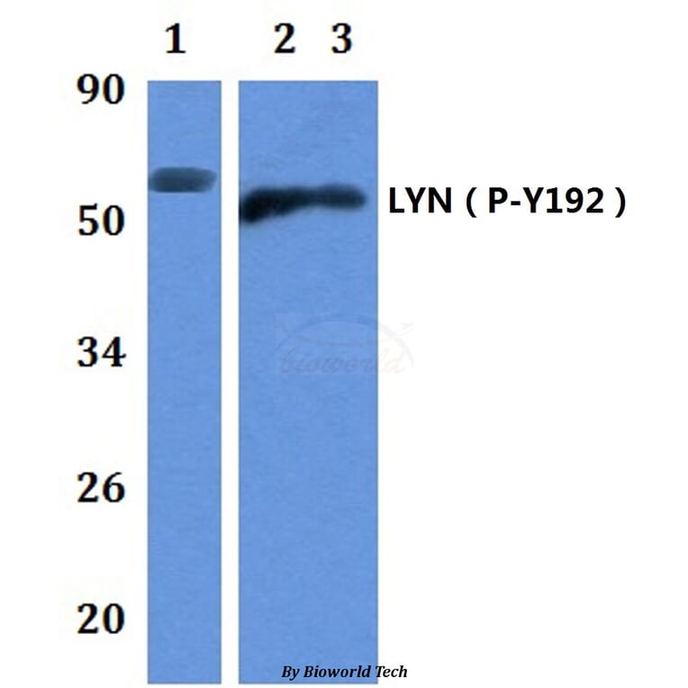 Anti-LYN (phospho-Y192) Antibody from Bioworld Technology (BS64043) - Antibodies.com