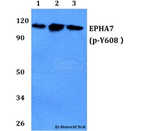 Anti-EPHA7 (phospho-Y608) Antibody from Bioworld Technology (BS64045) - Antibodies.com