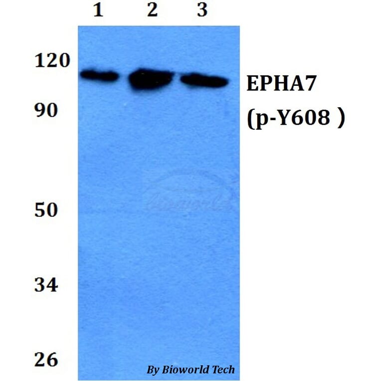 Anti-EPHA7 (phospho-Y608) Antibody from Bioworld Technology (BS64045) - Antibodies.com