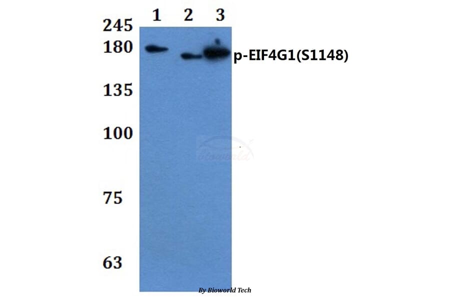 Anti-EIF4G1 (phospho-S1148) Antibody from Bioworld Technology (BS64046) - Antibodies.com