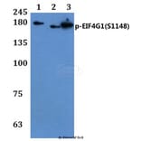 Anti-EIF4G1 (phospho-S1148) Antibody from Bioworld Technology (BS64046) - Antibodies.com