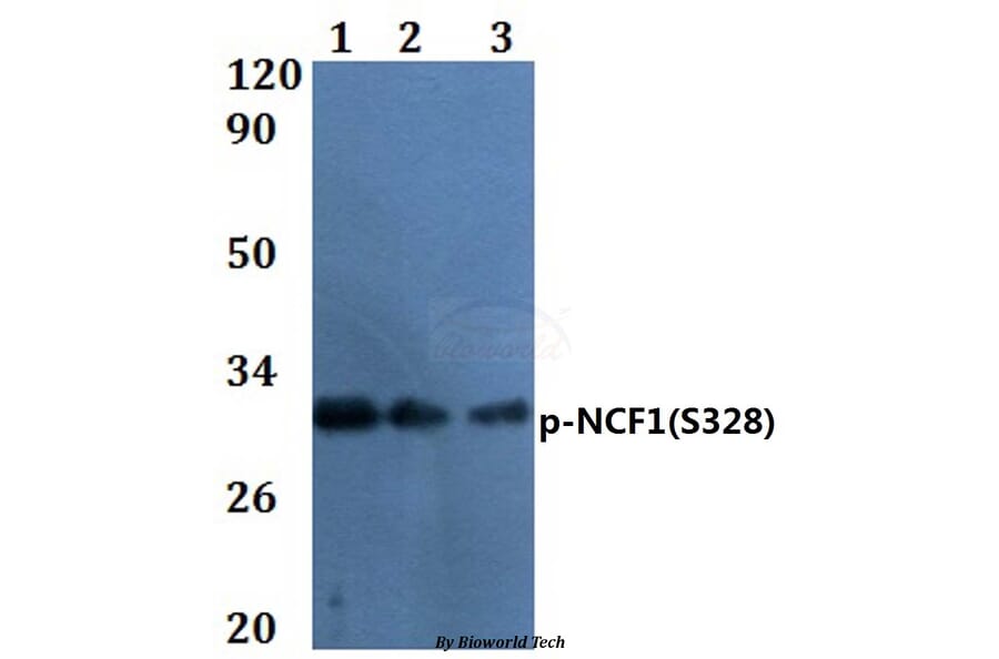 Anti-NCF1 (phospho-S328) Antibody from Bioworld Technology (BS64056) - Antibodies.com