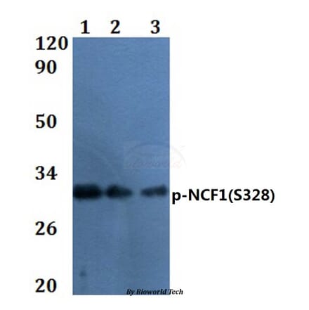 Anti-NCF1 (phospho-S328) Antibody from Bioworld Technology (BS64056) - Antibodies.com