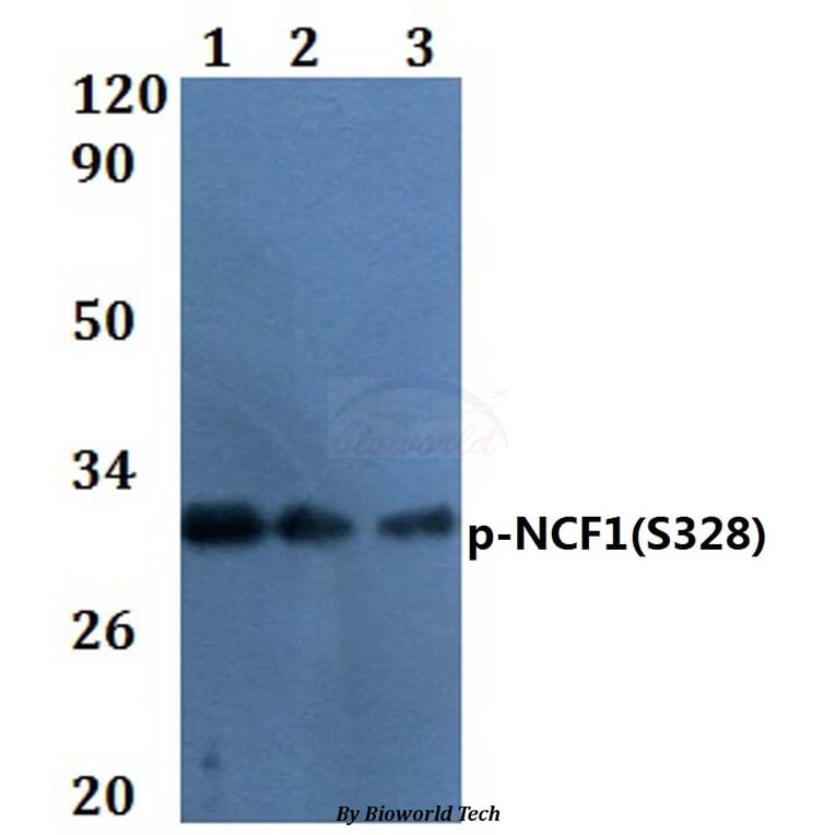 Anti-NCF1 (phospho-S328) Antibody from Bioworld Technology (BS64056) - Antibodies.com