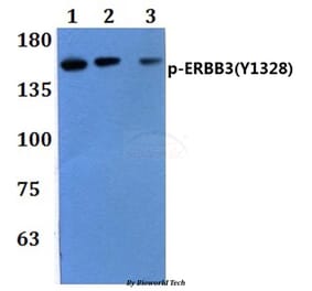 Anti-ERBB3 (phospho-Y1328) Antibody from Bioworld Technology (BS64082) - Antibodies.com