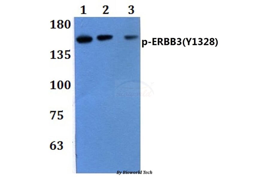 Anti-ERBB3 (phospho-Y1328) Antibody from Bioworld Technology (BS64082) - Antibodies.com