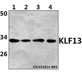 Anti-KLF13 (Acetyl-K166) Antibody from Bioworld Technology (BS64091) - Antibodies.com