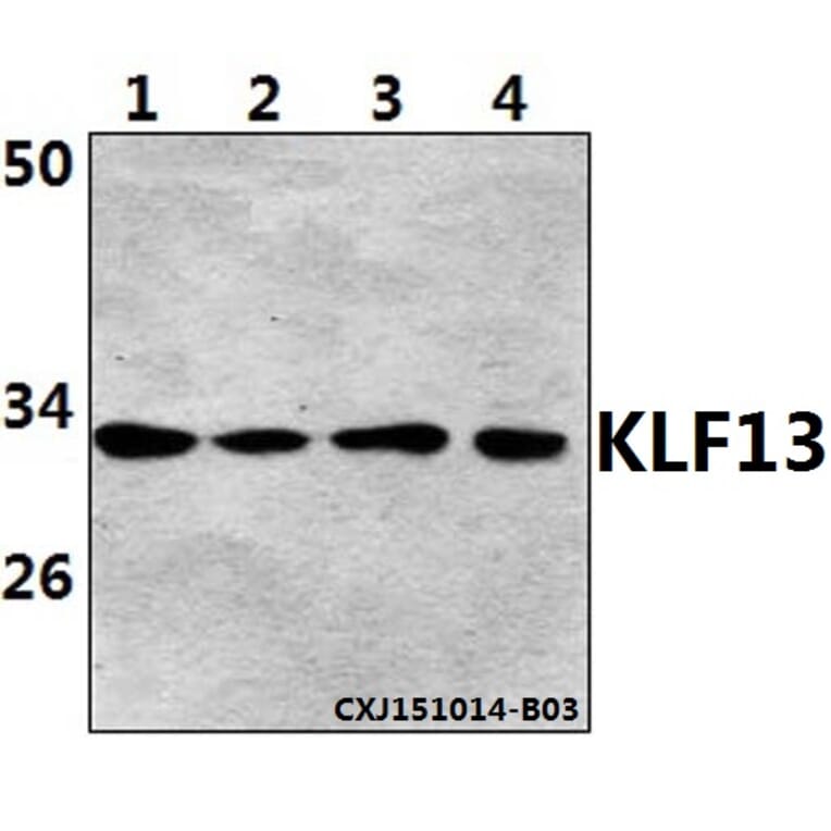 Anti-KLF13 (Acetyl-K166) Antibody from Bioworld Technology (BS64091) - Antibodies.com