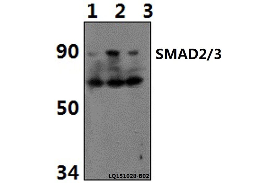 Anti-SMAD2/3 (Acetyl-K19) Antibody from Bioworld Technology (BS64092) - Antibodies.com