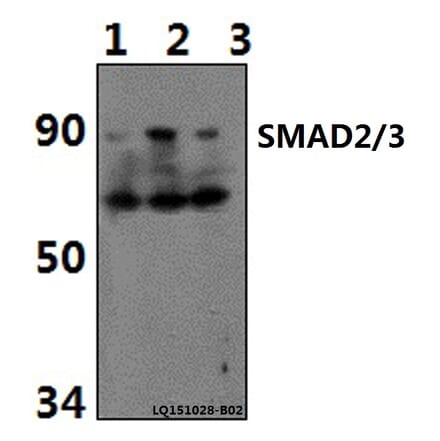 Anti-SMAD2/3 (Acetyl-K19) Antibody from Bioworld Technology (BS64092) - Antibodies.com