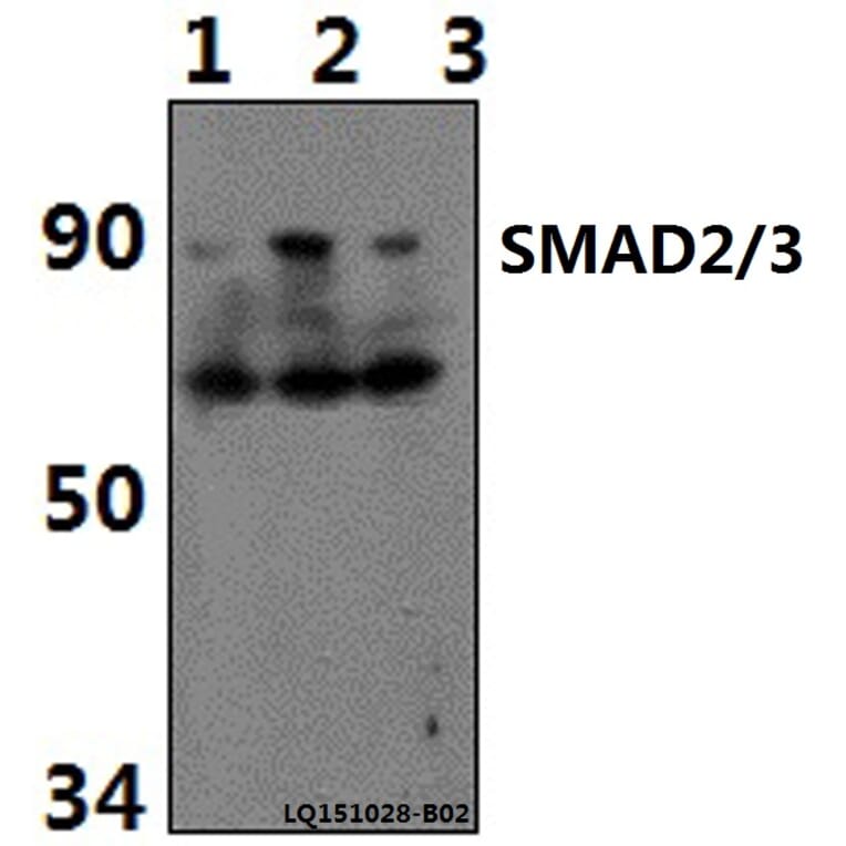 Anti-SMAD2/3 (Acetyl-K19) Antibody from Bioworld Technology (BS64092) - Antibodies.com