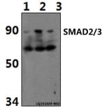 Anti-SMAD2/3 (Acetyl-K19) Antibody from Bioworld Technology (BS64092) - Antibodies.com