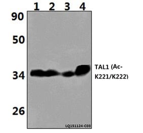 Anti-TAL1 (Acetyl-K221/K222) Antibody from Bioworld Technology (BS64094) - Antibodies.com