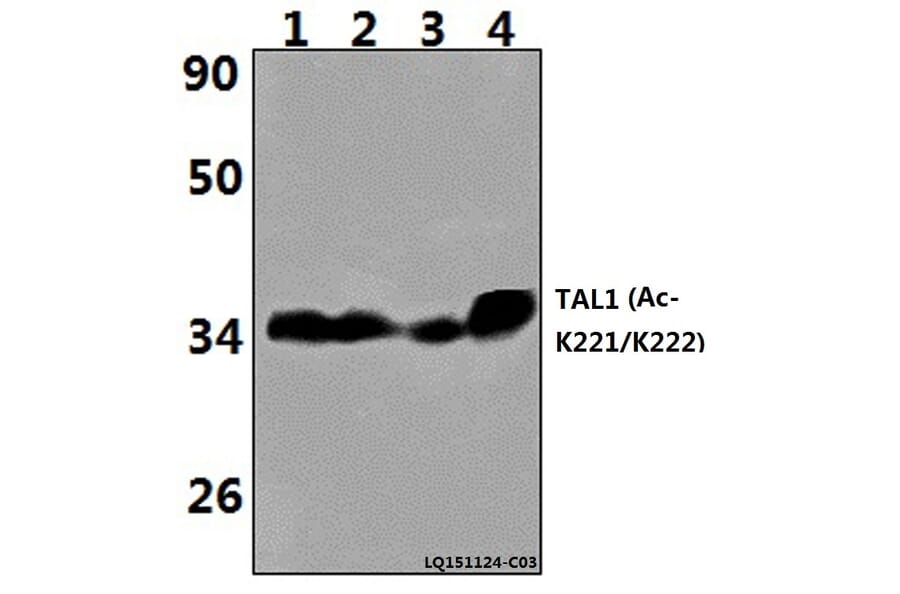 Anti-TAL1 (Acetyl-K221/K222) Antibody from Bioworld Technology (BS64094) - Antibodies.com