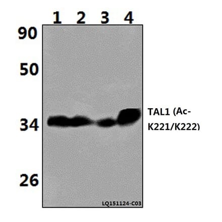 Anti-TAL1 (Acetyl-K221/K222) Antibody from Bioworld Technology (BS64094) - Antibodies.com