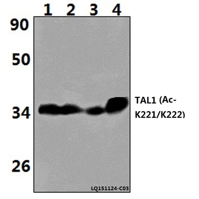 Anti-TAL1 (Acetyl-K221/K222) Antibody from Bioworld Technology (BS64094) - Antibodies.com